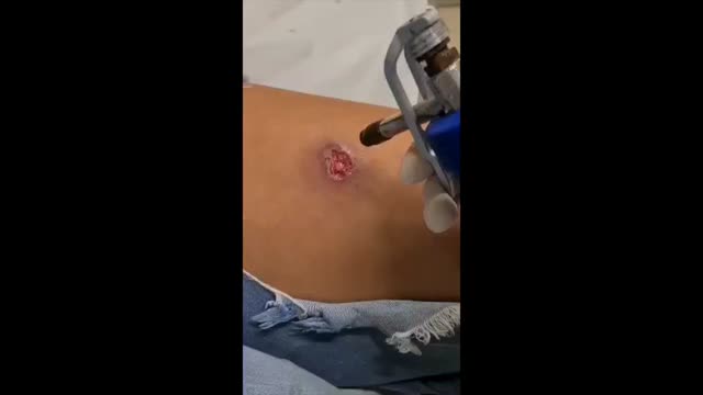https://ars.els-cdn.com/content/image/1-s2.0-S2666275222002144-mmc1.mp4