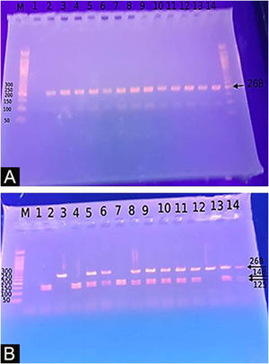 (A) Imagens de eletroforese em gel de agarose dos produtos de PCR: 268 pb. (B) Imagens de eletroforese em gel de agarose para SNPs de DEFB1 G20A, genótipo AA: 268 pb, genótipo GG: 143 pb, 125 pb, genótipo AG.