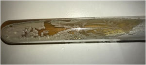 Na cultura, observaram‐se colônias branco‐creme, algumas rugosas com centros deprimidos, compatíveis com Prototheca spp