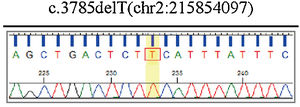 A análise de sequência realizada no presente caso identificou nova mutação patogênica do gene ABCA12 (ABCA12:c.3785delT), mutação frameshift e de deleção que leva a códon de terminação prematura