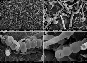 Microscopia eletrônica de varredura. (A) Pequeno aumento demonstrando filamentos (250×). (B) Médio aumento com clamidoconídios arredondados (setas; 1.400×). (C e D) Detalhe em grande aumento dos clamidoconídios (4.500× e 7.000×).