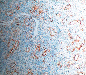 Avaliação por imuno‐histoquímica com marcação antitreponema (200×).