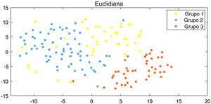 Subgrupos de 162 pacientes com DM pelo algoritmo tSNE. Gráfico de dispersão mostrando os indivíduos e grupos aos quais pertenciam na DM. O algoritmo tSNE foi utilizado para reduzir a dimensionalidade dos dados.
