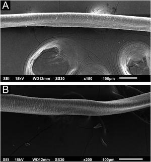 Microscopia eletrônica de varredura. (A) Fio de cabelo com canal longitudinal (×150). (B) Fio de cabelo com canal longitudinal e torção discreta (×200).