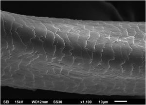 Microscopia eletrônica de varredura – grande aumento com detalhe de canal e torção (×1.100).