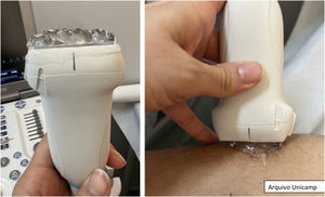 Quantidade a ser utilizada de gel e posicionamento perpendicular do probe.