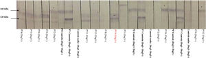 Immunoblotting com amostras de soro de 12 pacientes do grupo PF‐anti‐Dsg3+ (alguns com amostras consecutivas) e extrato proteico de epiderme humana. Controles positivos correspondem a amostras de pênfigo foliáceo (PF), que reconhecem a Dsg1 (160 kDa), e de pênfigo vulgar (PV), que reconhecem as Dsg1 e 3 (130 kDa). Controles negativos correspondem a amostras de indivíduos sadios. Observar as tiras de nitrocelulose com a banda de 160 kDa (*) correspondentes aos pacientes PF2, PF12 e PF16, e a banda de 130 kDa (**) correspondente ao PF10 para os títulos ELISA de anti‐Dsg1 e 3 (fig. 1A).