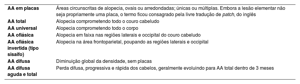 Tabelas