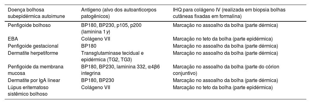 Tables