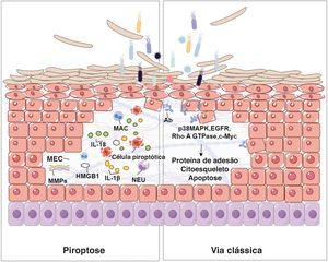 Relação entre piroptose e acantólise na epiderme. Células piroptóticas, caracterizadas pela formação de poros mediados por gasdermina, liberam citocinas pró‐inflamatórias, como IL‐1β e IL‐18. Essas citocinas atraem neutrófilos (NEU) e macrófagos (MAC), acentuando o ambiente inflamatório. O estresse oxidativo resultante e a produção de metaloproteinases da matriz (MMPs) podem degradar a matriz extracelular (MEC), enfraquecendo a integridade estrutural da epiderme e levando ao destacamento de queratinócitos, um processo conhecido como acantólise. Essa figura ilustra a interação complexa entre morte celular, inflamação e ruptura do tecido na patogênese de lesões bolhosas na pele. A parte direita da figura mostra a via clássica da acantólise no pênfigo. A interação bacteriana desencadeia a produção de anticorpos, ativando moléculas de sinalização (p38 MAPK, EGFR, Rho A GTPase, c‐Myc), que afetam o citoesqueleto e as proteínas de adesão, levando ao destacamento celular e à apoptose.