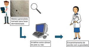 Como a IA pode melhorar o diagnóstico do câncer de pele? – Nevo na perna esquerda de paciente de 50 anos (arquivo UNICAMP).