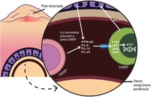 Este esquema apresenta a influência das células T CD4+ ou CD8+ nas células mononucleares do sangue periférico e sua influência no loop inflamatório em pacientes com psoríase. IL, interleucina; CMSP, células mononucleares do sangue periférico; IFN, interferon; TYK, tirosina quinase; JAK, Janus quinase; STAT, transdutor de sinal e ativador da transcrição.