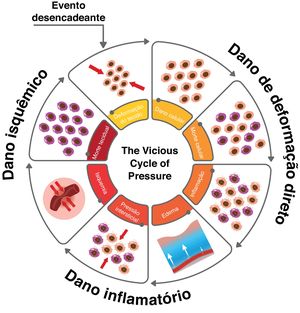 Ciclo vicioso da lesão por pressão: dano de deformação direta (dano celular, morte celular e inflamação), dano inflamatório (edema, aumento da pressão intersticial), dano isquêmico (isquemia, morte tecidual), levando à deformação celular. Adaptada de Gefen.[44].