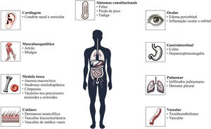 Manifestações clínicas da síndrome VEXAS.