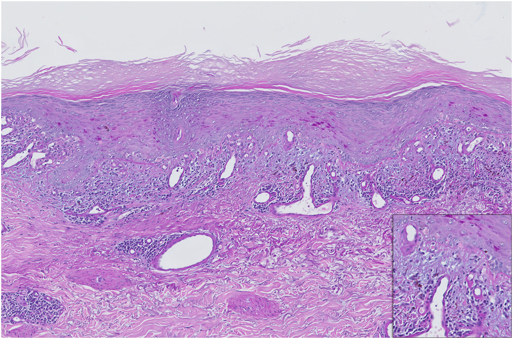 fig0010