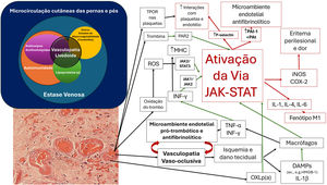Mecanismos propostos do envolvimento da via JAK/STAT na patogênese da vasculopatia livedoide, na promoção de um ambiente protrombótico e antifibrinolítico no ambiente cutâneo. COX2, ciclo‐oxigenase 2; DAMPs, padrões moleculares associados a dano; HMGB1, proteína 1 de alta mobilidade do grupo B; iNOS, óxido nítrico sintase induzível; IL, interleucina; IL‐1β, interleucina 1 beta; JAK‐STAT, Janus Kinase‐transdutor de sinal e ativação da transcrição; PAI 1, inibidor do ativador do plasminogênio tipo 1; MHC, complexo principal de histocompatibilidade; PAR2, receptor ativado por protease tipo 2; ROS, espécies reativas de oxigênio; tPA, ativador tecidual do plasminogênio; TNF‐α, fator de necrose tumoral alfa; TPO‐R, receptor da trombopoietina.