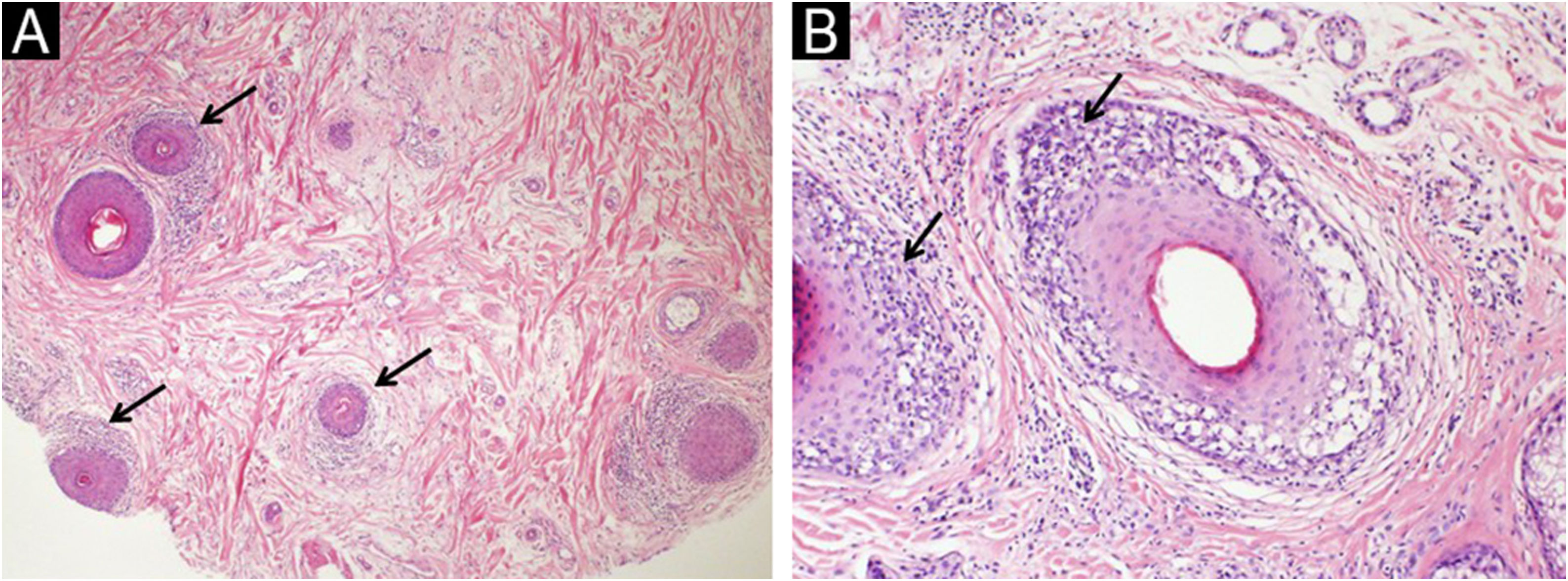 fig0010