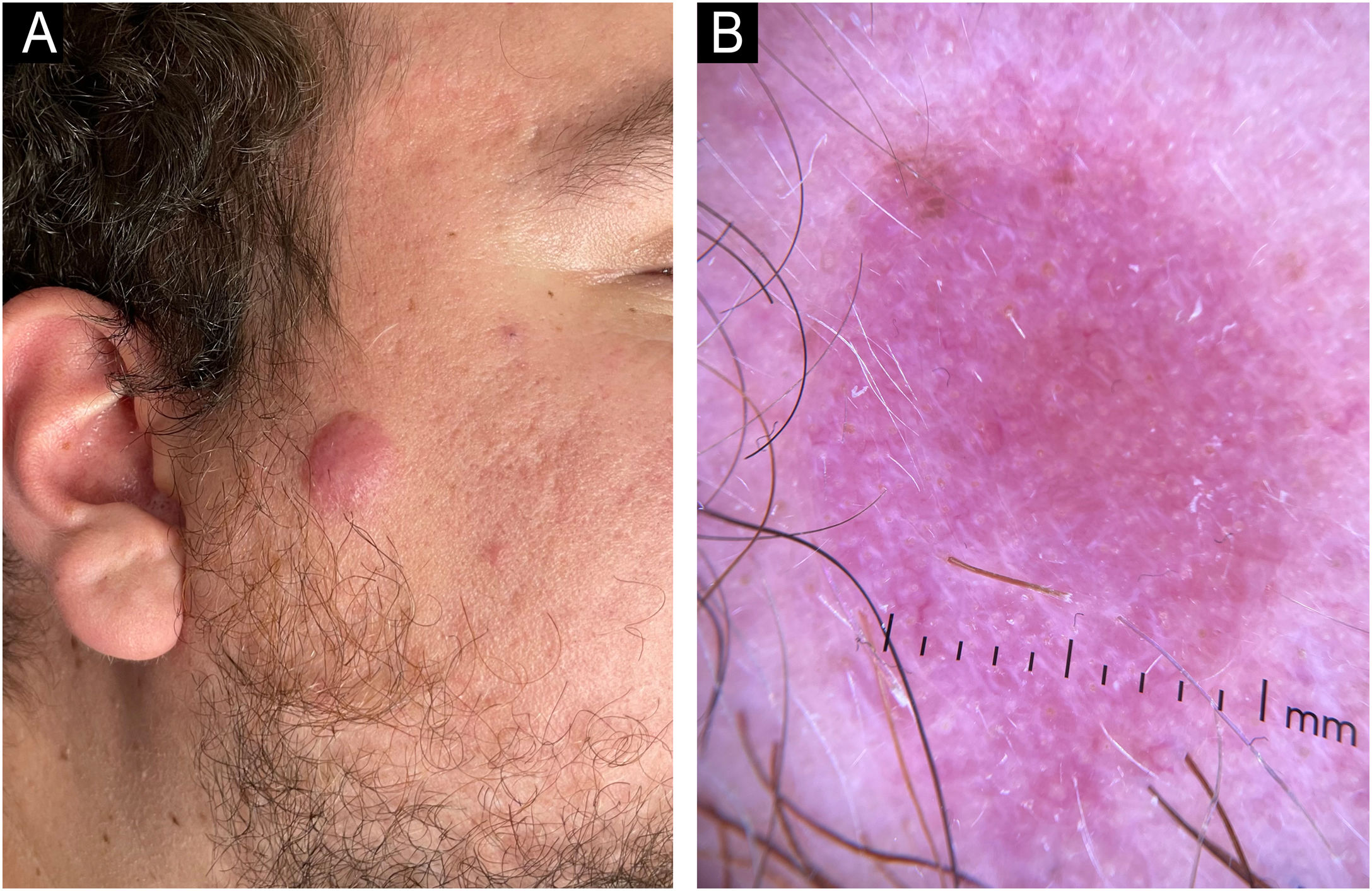 fig0010