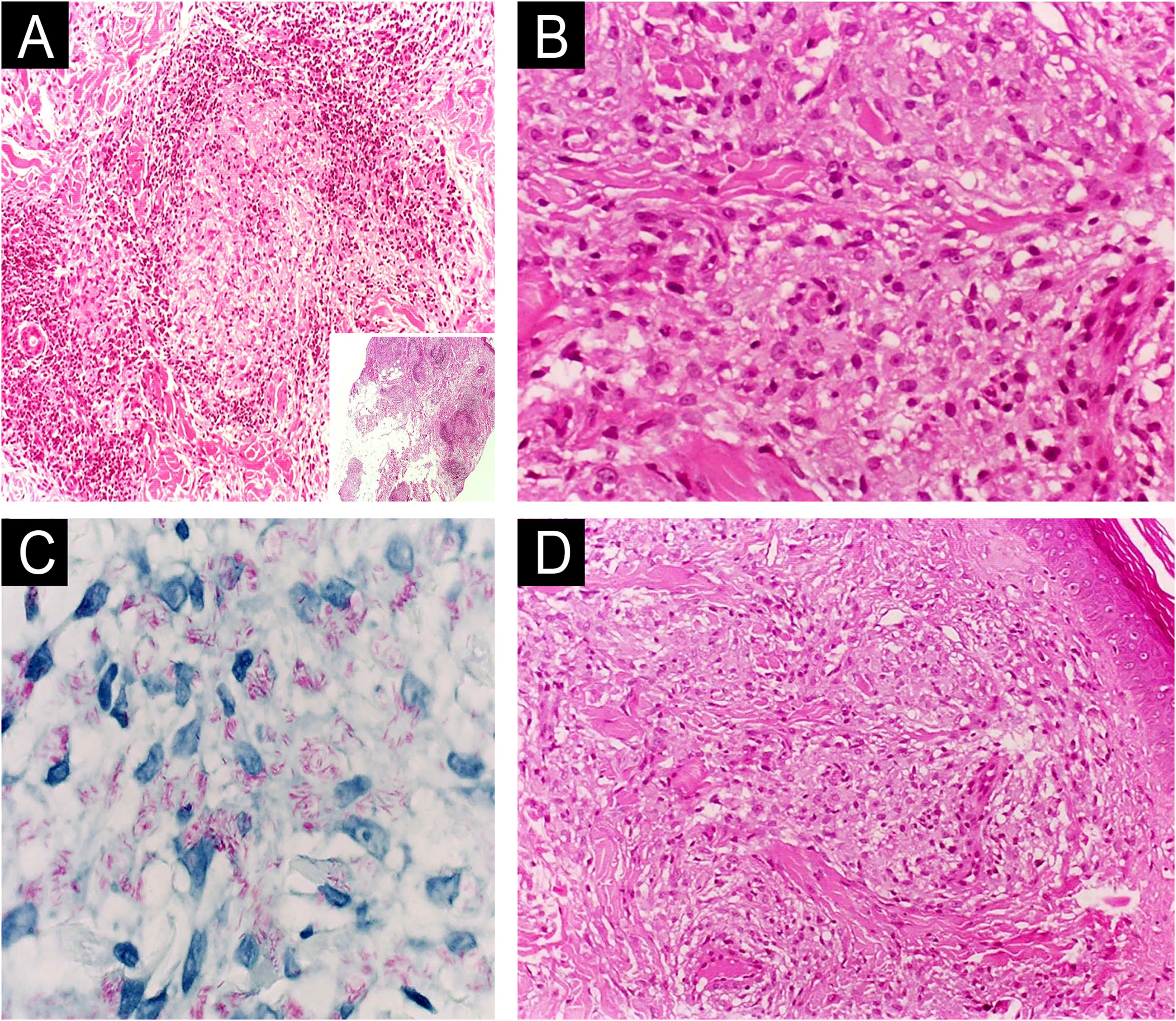 fig0010