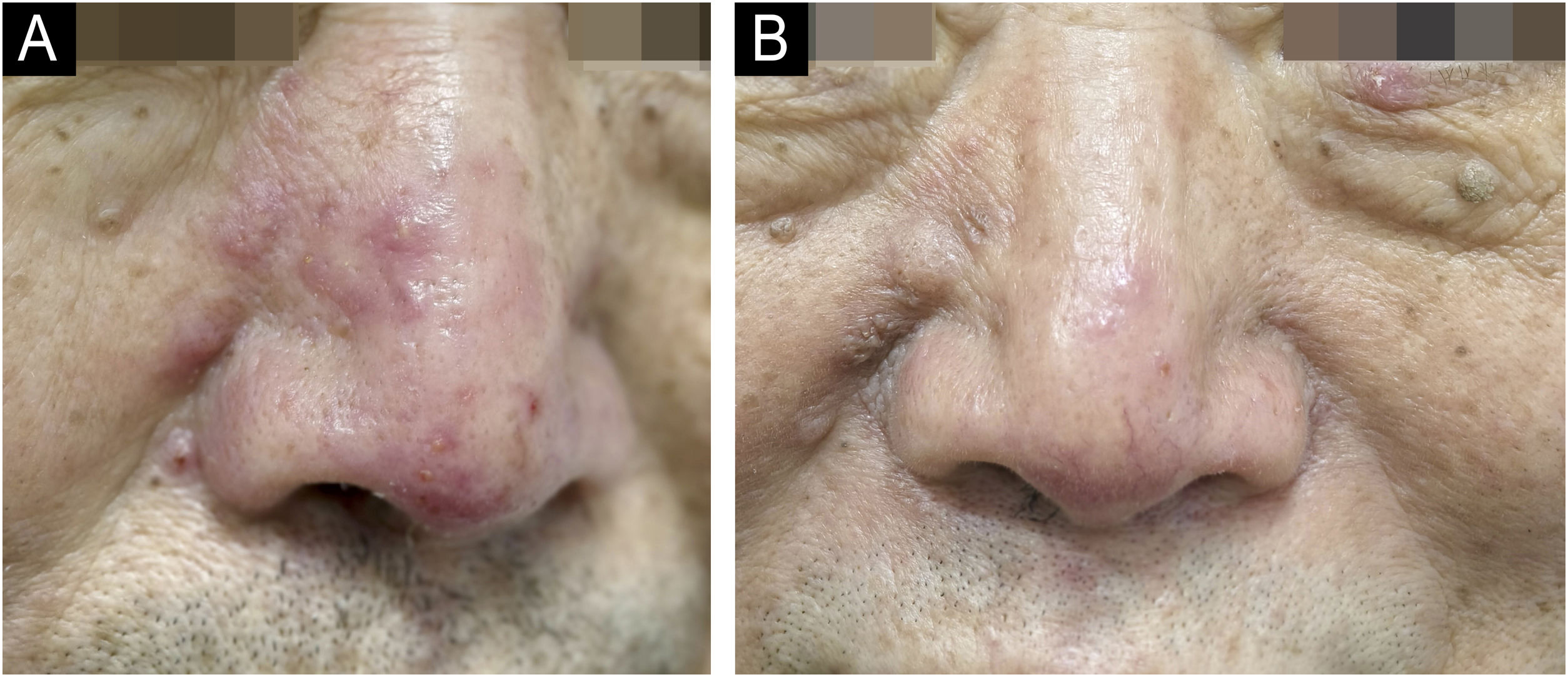 fig0005