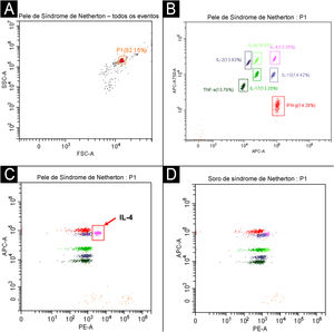 A análise do perfil de citocinas revela elevação tecido‐específica de IL‐4 em lesões cutâneas do paciente. Esquema da estratégia de gating para análise de citocinas em microesferas. (A‐B) A população de microesferas alvo (P1) foi selecionada com base na dispersão frontal e lateral (FSC‐A/SSC‐A). (B) Dentro da população P1, sete subconjuntos distintos de microesferas foram diferenciados pelos sinais de APC‐A e APC‐A750‐A, cada um correspondendo a uma citocina específica para detecção (IL‐2, IL‐4, IL‐6, IL‐10, IL‐17, TNF‐α e IFN‐γ); a quantificação de cada citocina foi realizada por meio do canal de fluorescência PE. (C) Elevação seletiva de IL‐4 na pele lesionada (71,33 pg/mg, indicada por uma seta vermelha) em comparação com os níveis de referência normais, enquanto outras citocinas importantes – incluindo IL‐2, IL‐6, IL‐10, IL‐17, TNF‐α e IFN‐γ – estavam dentro dos limites normais. (D) Todas as concentrações de citocinas no sangue periférico estavam dentro da faixa normal. Os níveis de citocinas foram quantificados por citometria de fluxo usando um ensaio de microesferas comercial (Microtech Biotech Co., Ltd.) e analisados com o software BD FCAP Array.