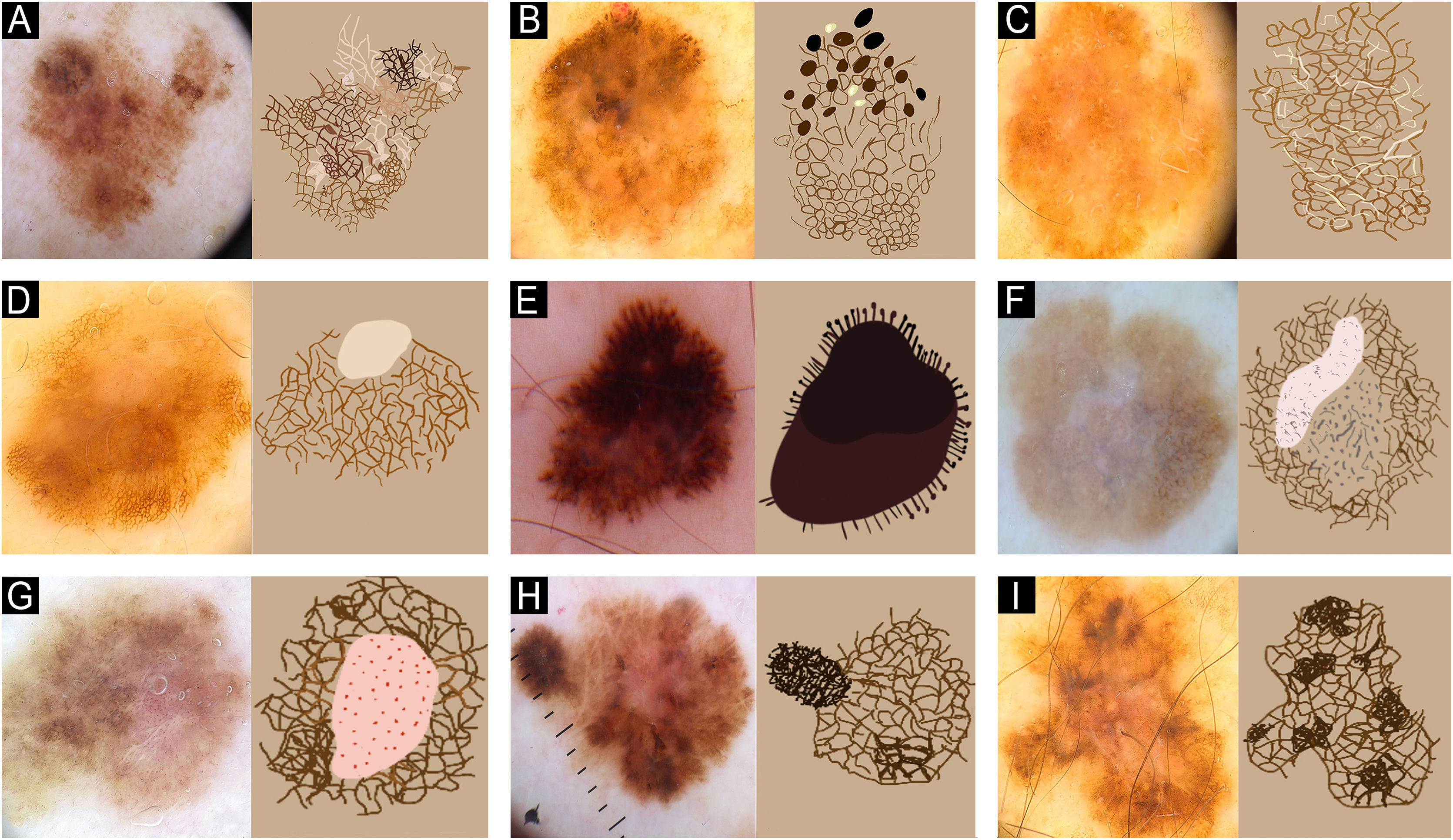 fig0015