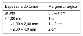 Tables