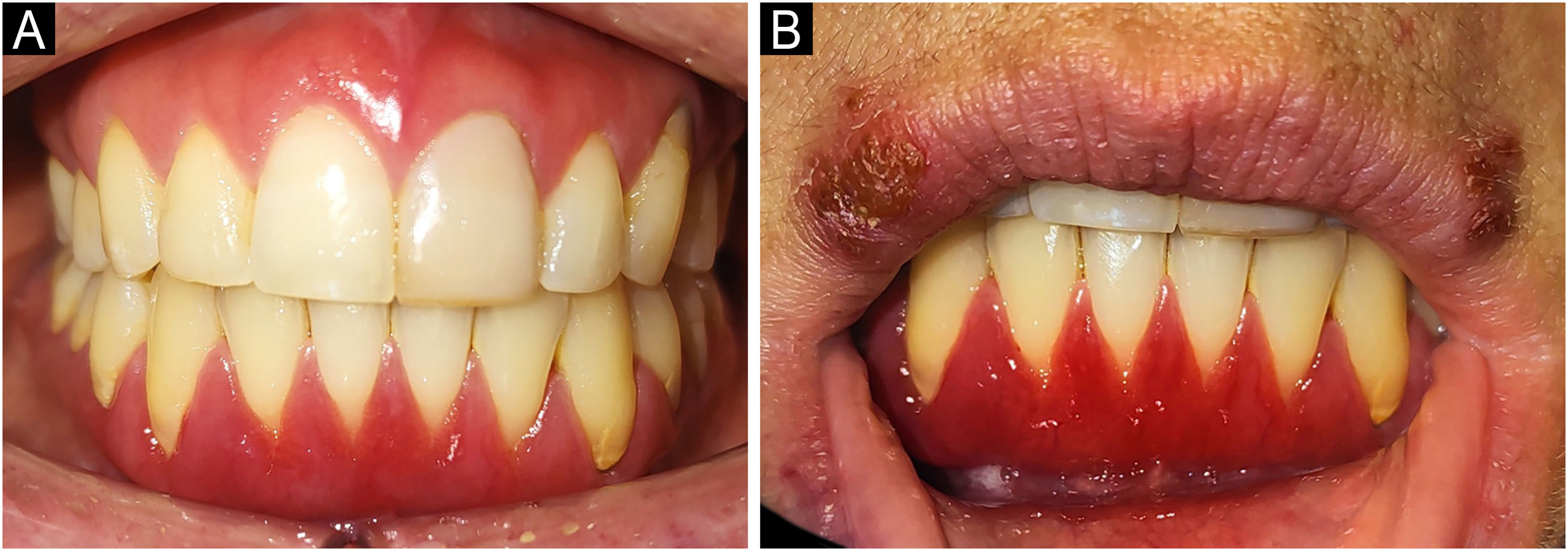 fig0005