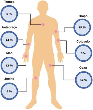 Porcentagens de apresentação das lesões de cromoblastomicose (CBM). Distribuição topográfica das lesões de CBM.