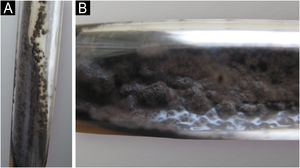 Características macroscópicas da cultura. Os isolados cultivados em ágar Sabouraud apresentaram colônias aveludadas pretas ou acinzentadas, nas quais foram identificadas as formas reprodutivas de Fonsecaea sp., Cladosporium, Rhinocladiella e, ocasionalmente, fiálides.