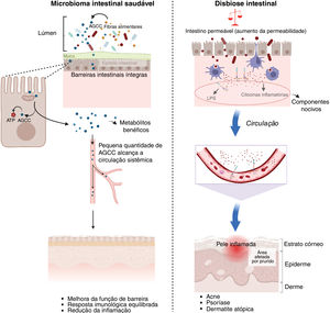 Eixo intestino‐pele e saúde sistêmica. Visão geral comparativa de microbioma intestinal saudável, que produz metabólitos benéficos como os ácidos graxos de cadeia curta (AGCC) que auxiliam na função de barreira da pele, versus disbiose intestinal. Na disbiose intestinal, o “intestino permeável” propicia a translocação de lipopolissacarídeo (LPS) e citocinas inflamatórias para a circulação sanguínea, agravando condições inflamatórias da pele, como acne e psoríase. Criado em https://BioRender.com.