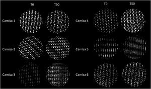 Fotografia microscópica (ampliação de 40×) das estruturas entretecidas das seis marcas estudadas antes da lavagem (T0) e após 50 ciclos de lavagem (T50). Após repetidos ciclos de lavagem e secagem ao sol, observam‐se alterações estruturais em diversas amostras, incluindo modificações na organização das fibras e no espaçamento entre elas. A heterogeneidade dessas alterações entre as marcas pode explicar parcialmente a variabilidade detectada na transmitância ultravioleta e no FPU estimado, reforçando a influência da composição têxtil e da estabilidade estrutural no desempenho fotoprotetor.