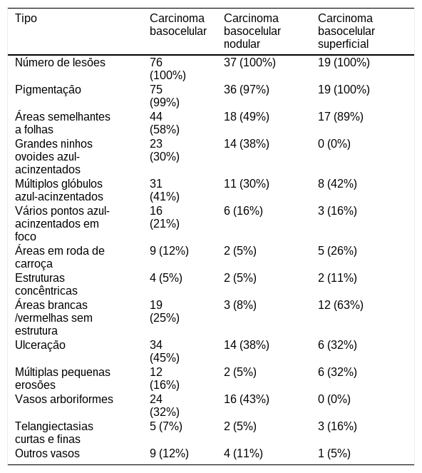 Tables
