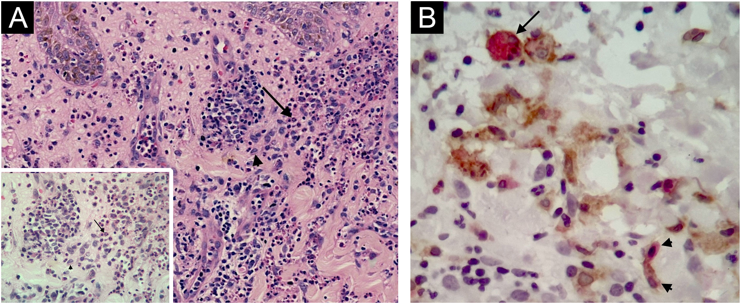 fig0005