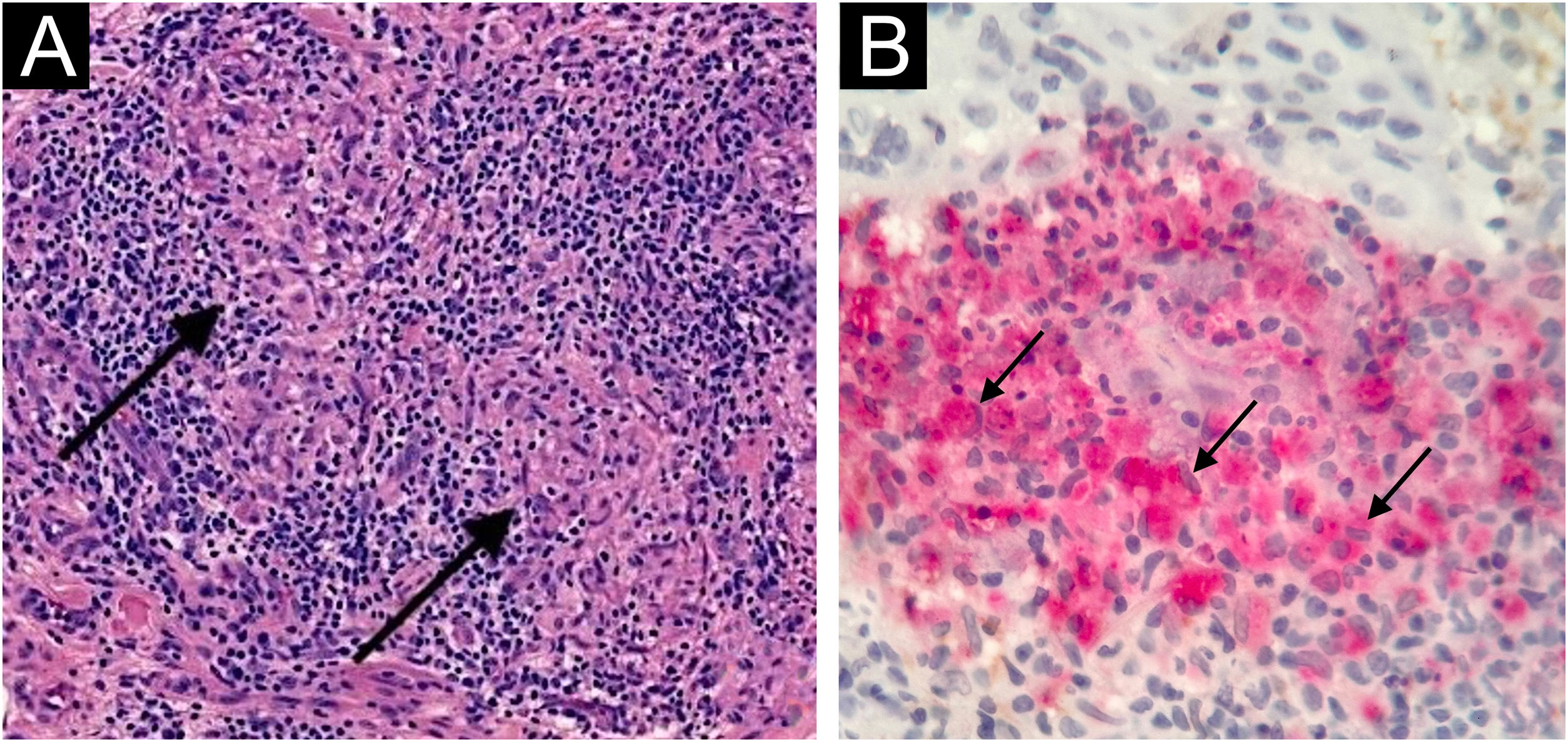 fig0020