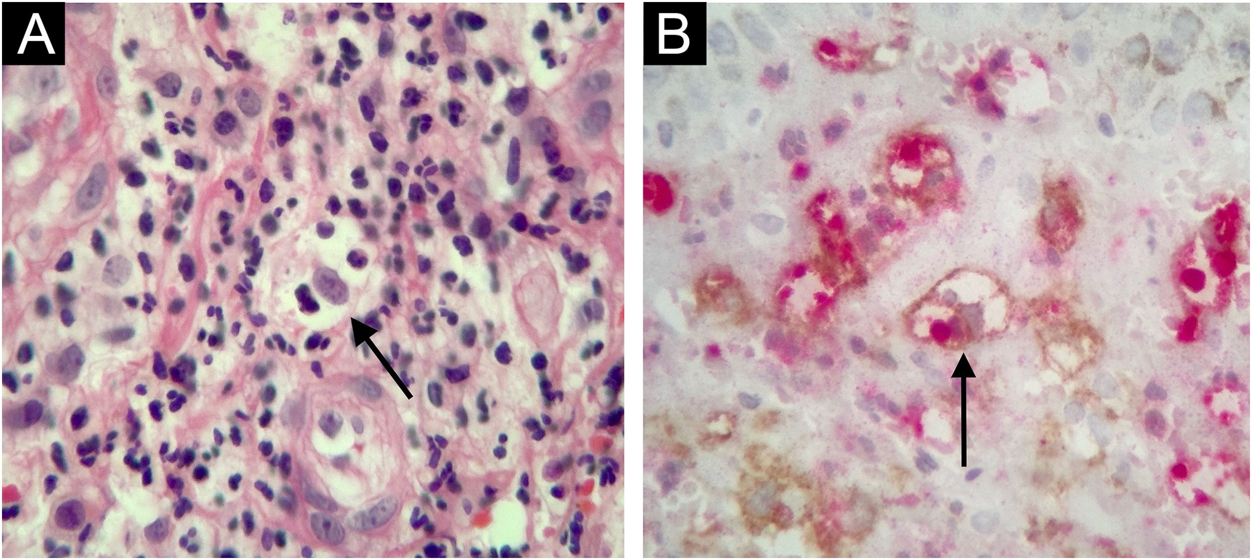 fig0025