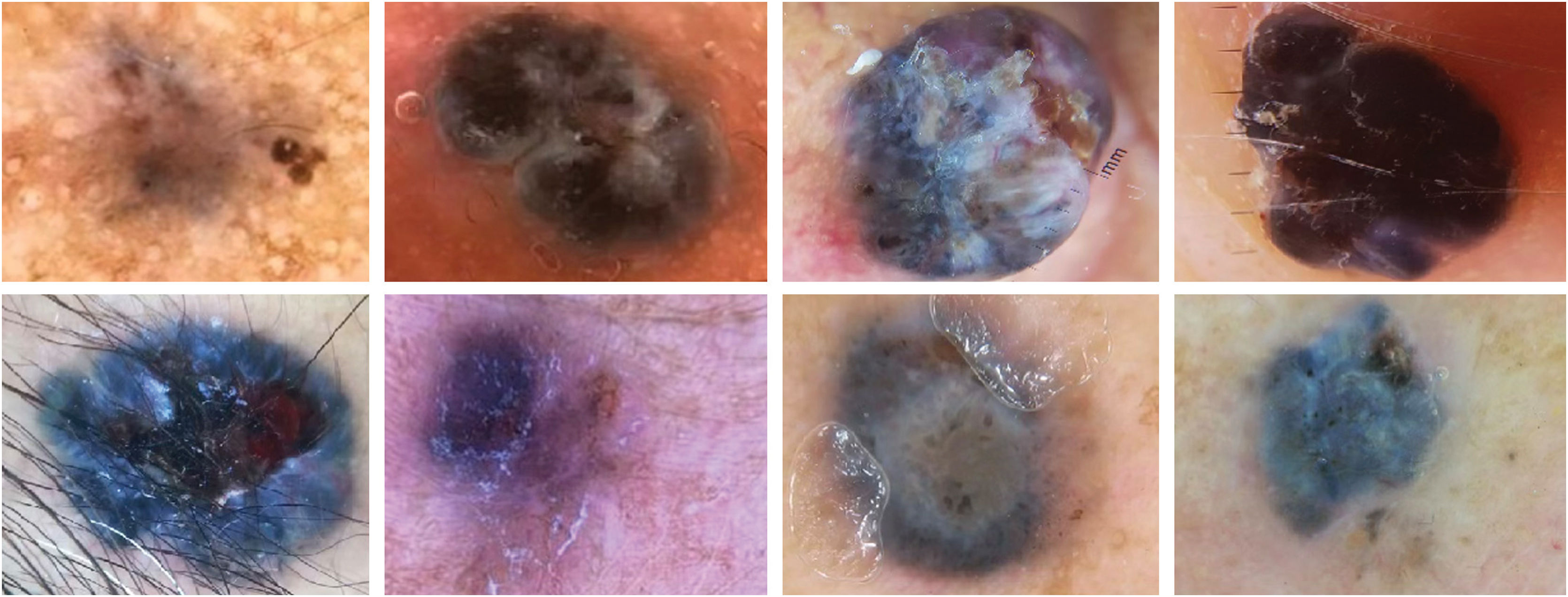 fig0010