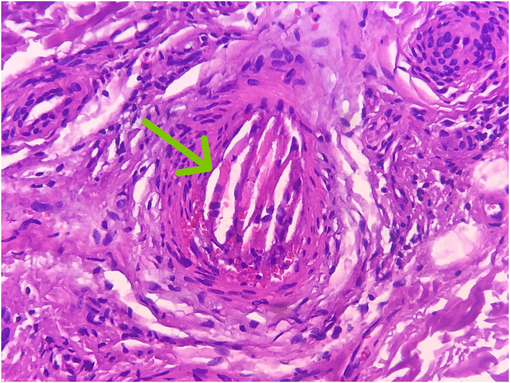 fig0010