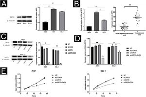 O silenciamento de SIRT6 inibiu a proliferação de células de CECC. (A) Análise de Western blot da expressão da proteína SIRT6 em células A431, SCL‐1 e HaCaT. (B) Análise qRT‐PCR da expressão de mRNA de SIRT6 em células A431, SCL‐1 e HaCaT, bem como em 20 amostras de CECC e pele normal adjacente. (C‐D) Validação dos efeitos de silenciamento da proteína e mRNA de SIRT6 em células A431 e SCL‐1. (E) Ensaio CCK‐8 de proliferação de células de CECC, medindo a absorbância a 450nm em 12, 24, 48 e 72 horas; *p<0,05, **p<0,01.