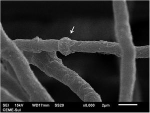 MEV ‐ detalhe de uma dilatação em uma hifa (seta), semelhante às vistas na microscopia óptica (8.000×).