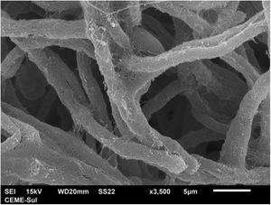 MEV ‐ hifas recobertas com matriz extracelular microfibrilar (3.500×).