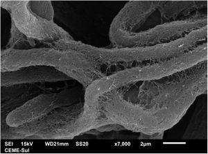 MEV ‐ grande aumento, demonstrando em detalhe a aderência entre as hifas pela matriz reticular (7.000×).