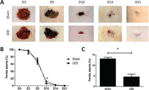 Efeito da terapia com LED na cicatrização cutânea de ratos Wistar. (A) Imagens clínicas representativas do processo de cicatrização de feridas de espessura total induzidas nos grupos experimentais durante os diferentes períodos de análise. Observe que no dia 10 o grupo LED apresentou uma área de ferida significantemente menor em comparação ao grupo Sham. (B) Porcentagem de fechamento da ferida em diferentes tempos experimentais normalizada para a área basal da ferida (dia 0). (C) Porcentagem principal e DP de fechamento da ferida no dia 10 nos grupos Sham (13,16±1,50) e LED (4,62±2,53). Asteriscos denotam resultados significantes.