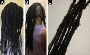 Diferentes tipos de dreadlocks (A‐B). Imagem em close‐up (C) que mostra como o cabelo despenteado é torcido para formar esses cachos chamados de “locks”.