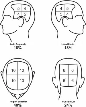 Escore SALT para determinação de área de perda capilar secundária à alopecia areata. Na imagem, observa‐se o percentual de cada região e a subdivisão destes em quadrantes. O avaliador deve estimar a área de alopecia em cada uma das regiões e somá‐las. Áreas de alopecia incluem aquelas com ausência de fios ou com finos velos, e as áreas repiladas obrigatoriamente com fios terminais. O escore SALT resultará da soma desses valores. Por exemplo, paciente com alopecia que compromete metade da região superior e um quarto da região posterior terá um escore SALT de 20 + 6 = 26.