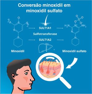 Conversão do minoxidil em sua forma ativa, minoxidil sulfato.