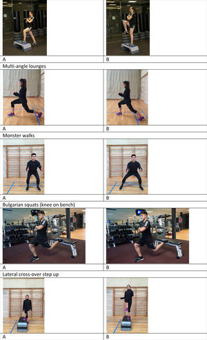 Conservative exercises for femoroacetabular impingement in professional basketball for the preseason period.