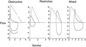 Morphology of flow-volume curve in different respiratory functional patterns.