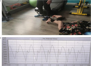 (a, b) Explosive strength test using digital power scale. Patient position and example of power scale in series of 8 repeats.