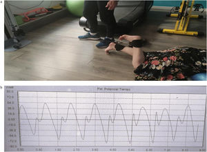(a, b) Explosive strength test using digital power scale. Patient position and example of power scale in series of 8 repeats.